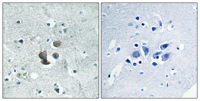 a02410 igfbp7 primary antibodyes ihc testing 1