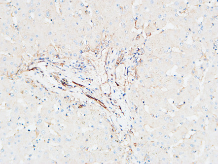 Immunohistochemical analysis of paraffin-embedded Human Liver