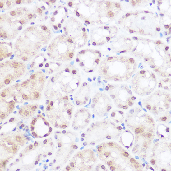 Immunohistochemistry analysis of paraffin-embedded mouse kidney using BRD2 pAb at dilution of 1:50 (40x lens)