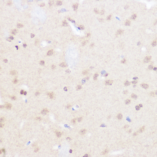 a02412 brd2 primary antiboties ihc testing 4