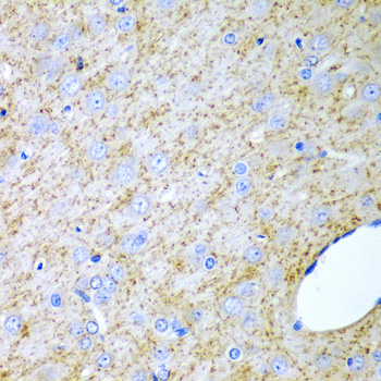 Immunohistochemistry of paraffin-embedded rat brain using Inhibin alpha  antibody  at dilution of 1:200 
