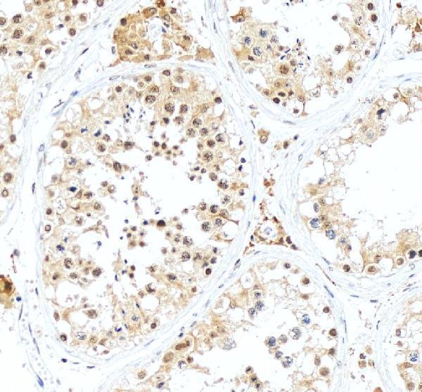 a02413 3 inha primary antibodies ihc testing 3