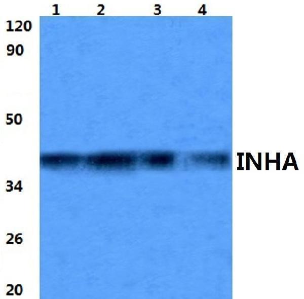 Western blot (WB) analysis of INHA polyclonal antibody at 1:500 dilution
Lane1:sp2/0 whole cell lysate
Lane2:PC12 whole cell lysate
Lane3:H9C2 whole cell lysate
Lane4:A549 whole cell lysate