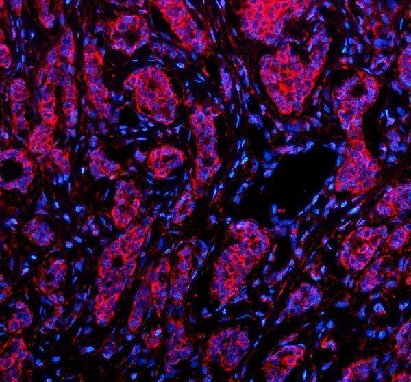 a02414 1 rb1cc1 primary antibodies if testing 1
