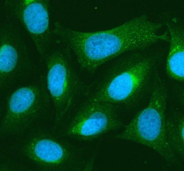 a02414 1 rb1cc1 primary antibodies if testing 2