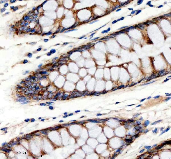 IHC analysis of RB1CC1 using anti-RB1CC1 antibody (A02414-1)