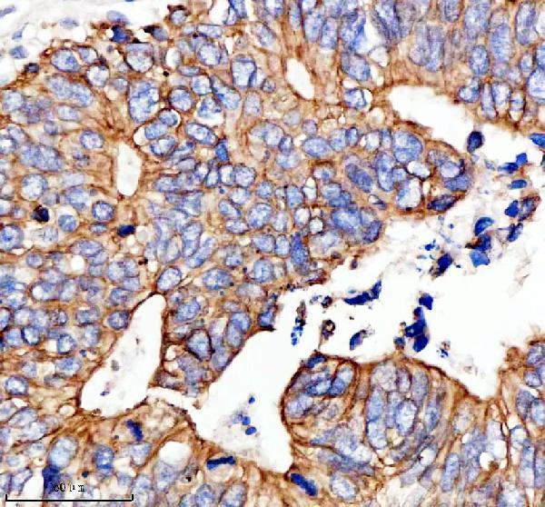 a02414 1 rb1cc1 primary antibodies ihc testing 2