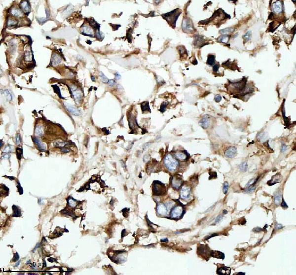 a02414 1 rb1cc1 primary antibodies ihc testing 3