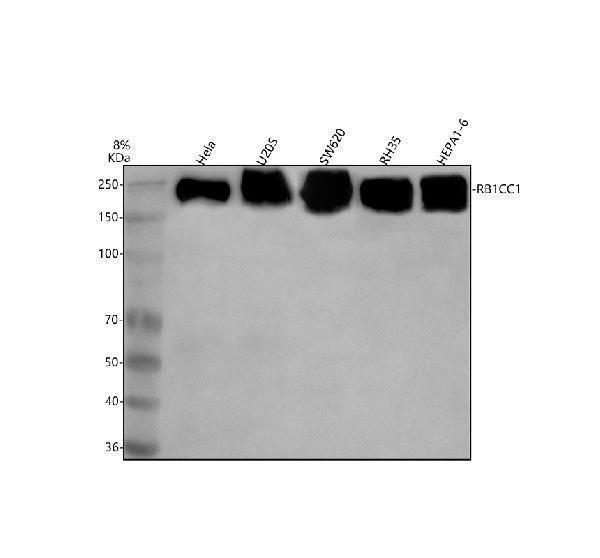  Western blot analysis of RB1CC1 using anti-RB1CC1 antibody (A02414-1)