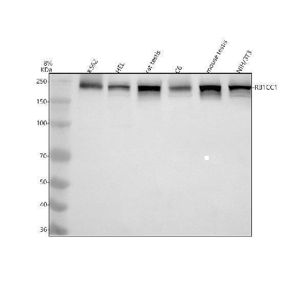 Western blot analysis of RB1CC1 using anti-RB1CC1 antibody (A02414-1)