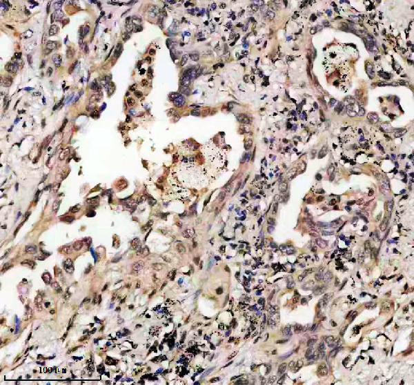 IHC analysis of RECQL using anti-RECQL antibody (A02415)