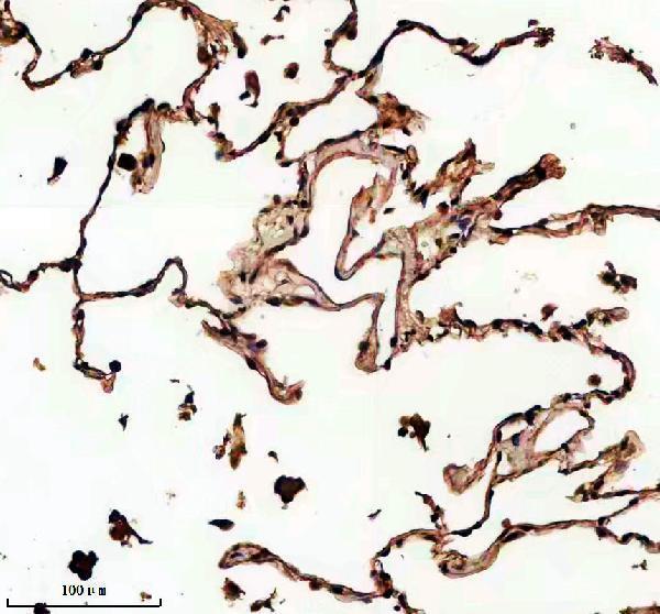 IHC analysis of RECQL using anti-RECQL antibody (A02415)