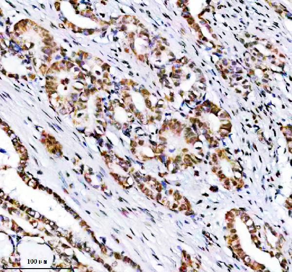 a02415 recql primary antibodies ihc testing 3