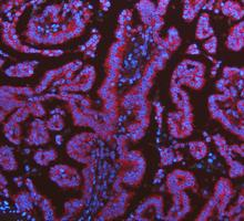 a02416 2 krt7 primary antibodies if testing 10