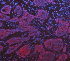 a02416 2 krt7 primary antibodies if testing 11