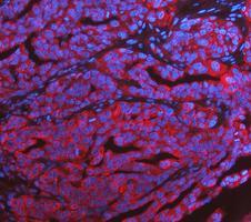 a02416 2 krt7 primary antibodies if testing 12