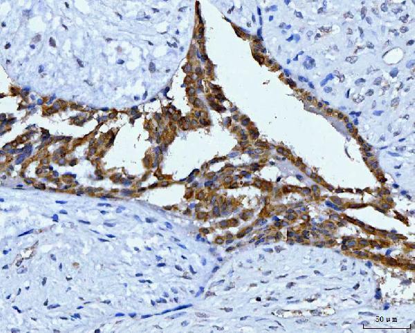  IHC analysis of KRT7 using anti-KRT7 antibody (A02416-2)