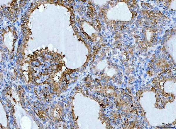  IHC analysis of KRT7 using anti-KRT7 antibody (A02416-2)