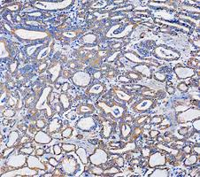 a02416 2 krt7 primary antibodies ihc testing 5