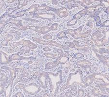 a02416 2 krt7 primary antibodies ihc testing 6