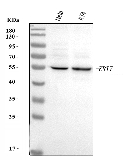  Western blot analysis of KRT7 using anti-KRT7 antibody (A02416-2)