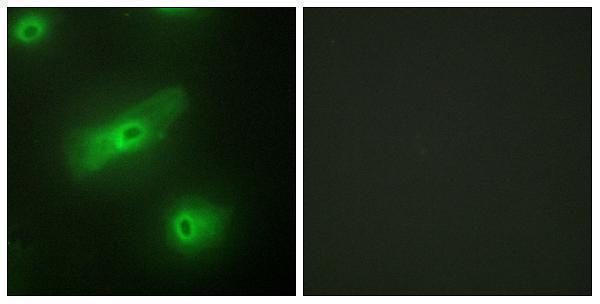 a02417 1 tnfsf13 primary antibodies if testing 1