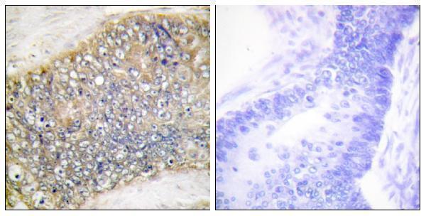a02417 1 tnfsf13 primary antibodies ihc testing 5