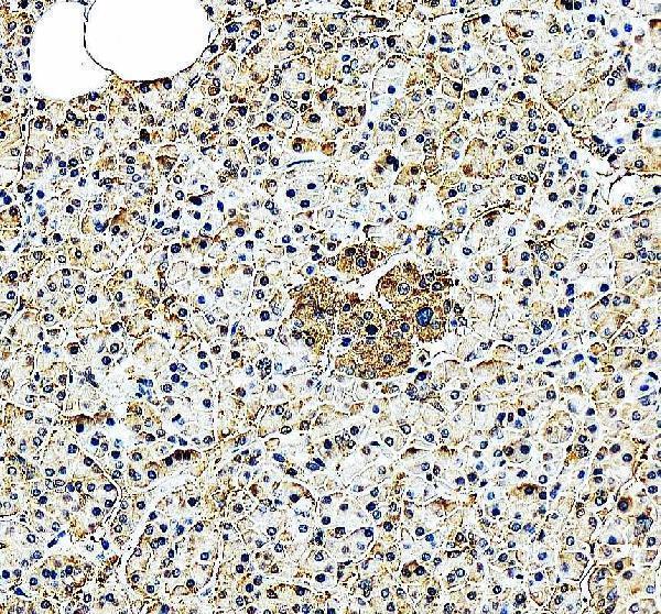 IHC analysis of EIF2A using anti-EIF2A antibody (A02418-1)