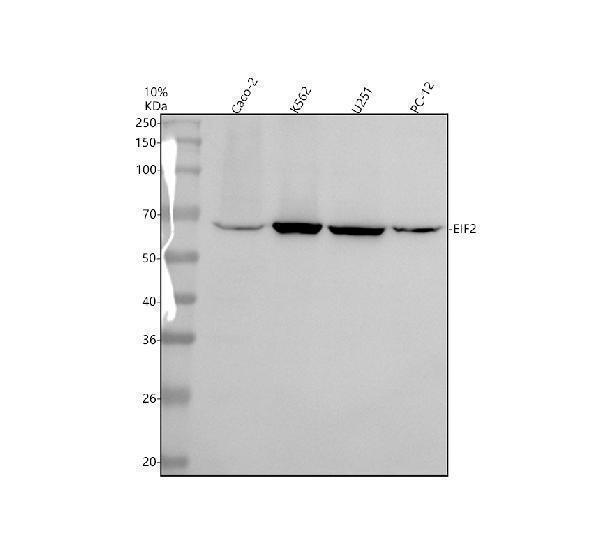Western blot analysis of EIF2A using anti-EIF2A antibody (A02418-1)