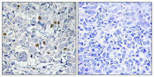 Immunohistochemistry validation of NR2F2 using Anti-ARP-1 NR2F2 Antibody (A02420-1)