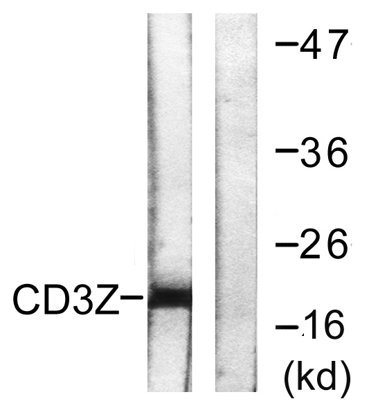 Western blot analysis of lysates from Jurkat cells, treated with UV 15', using CD3 zeta Antibody