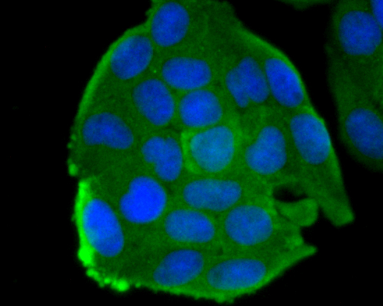 ICC staining smooth muscle Myosin heavy chain 11 in Hela cells (green)
