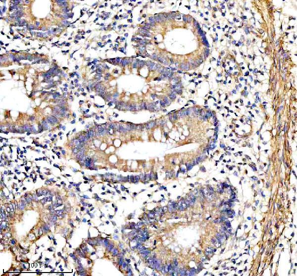  IHC analysis of SMMHC/MYH11 using anti-SMMHC/MYH11 antibody (A02422-2)