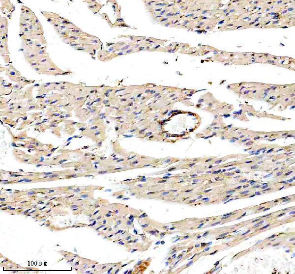  IHC analysis of SMMHC/MYH11 using anti-SMMHC/MYH11 antibody (A02422-2)