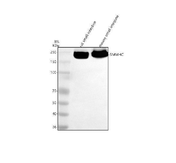 Western blot analysis of SMMHC/MYH11 using anti-SMMHC/MYH11 antibody (A02422-2)