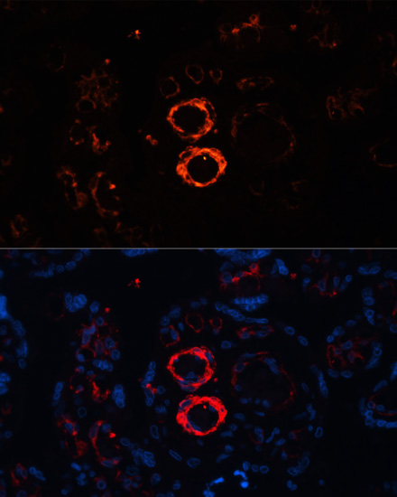 Immunofluorescence analysis of human placenta cells using SMMHC/SMMHC/MYH11 antibody  at dilution of 1:100