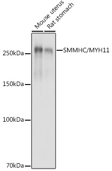 Western blot analysis of extracts of various cell lines, using SMMHC/MYH11 antibody  at 1:500 dilution