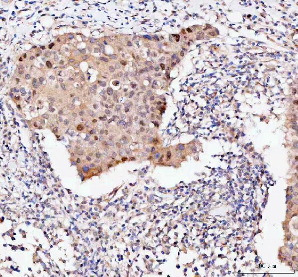 a02423 2 bag1 primary antibodies ihc testing 2