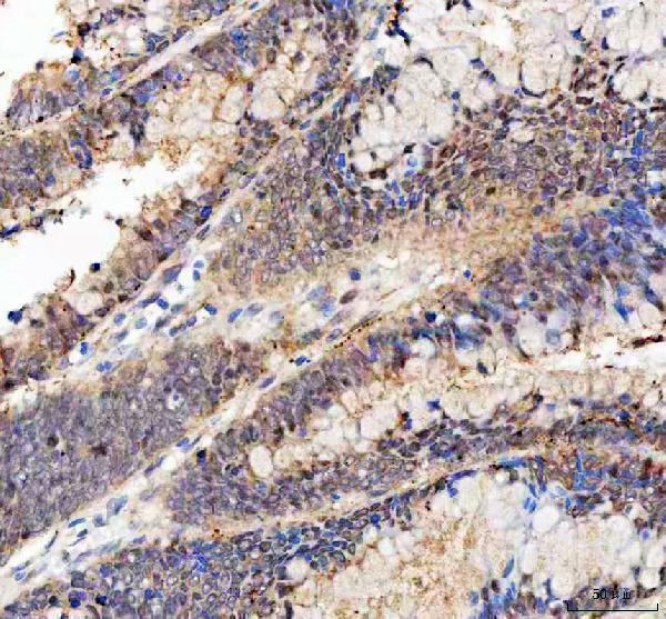 a02423 2 bag1 primary antibodies ihc testing 3