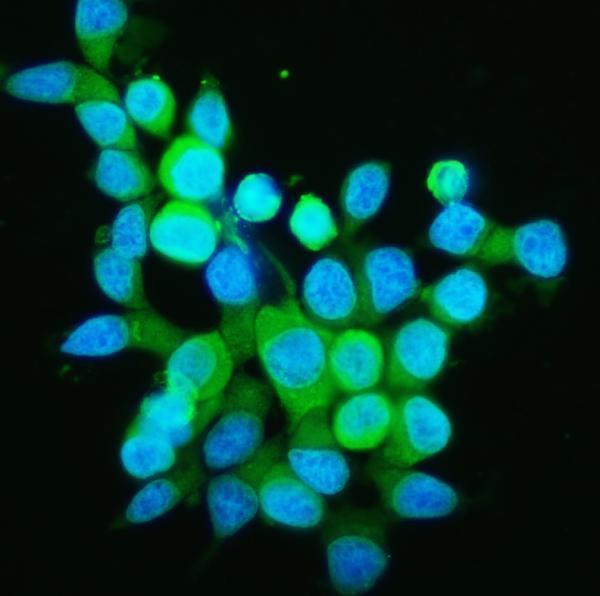 a02424 ppid primary antibodies if testing 7