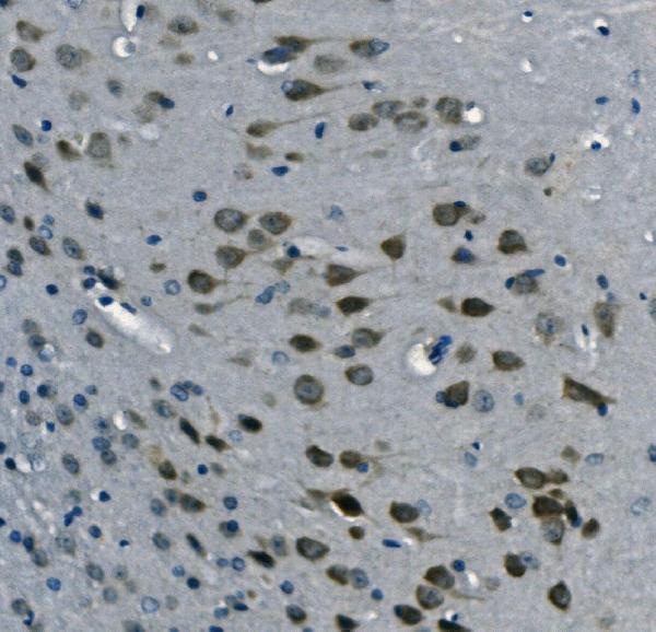 a02425 2 pcbp2 primary antibodies ihc testing 2