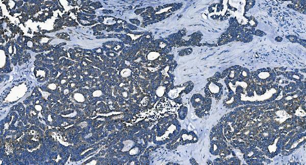 a02425 2 pcbp2 primary antibodies ihc testing 4