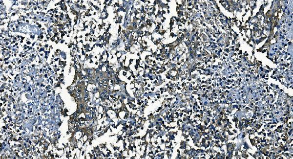 a02425 2 pcbp2 primary antibodies ihc testing 5