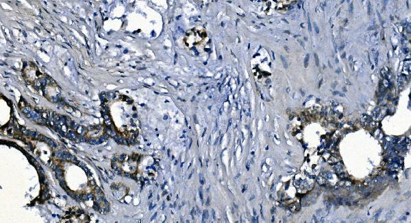 a02425 2 pcbp2 primary antibodies ihc testing 6