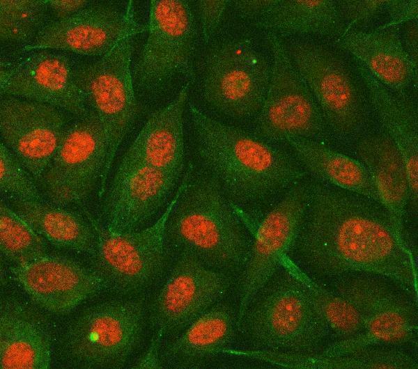  IF analysis of hnRNP E2/PCBP2 using anti-hnRNP E2/PCBP2 antibody (A02425-3) and anti-Tubulin Alpha antibody (M03989-3)