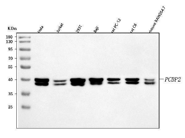  Western blot analysis of hnRNP E2/PCBP2 using anti-hnRNP E2/PCBP2 antibody (A02425-3)