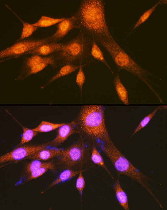 Immunofluorescence analysis of NIH-3T3 cells using hnRNP E2/PCBP2 Rabbit pAb  at dilution of 1:100 