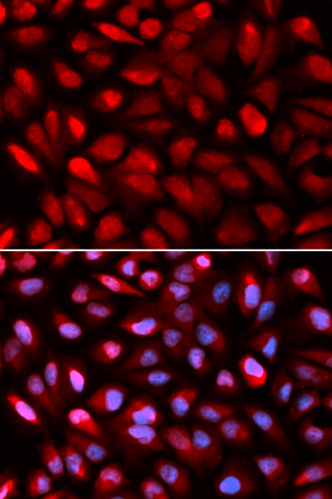 a02425 pcbp2 primary antiboties ihc testing 3