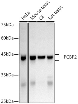 Western blot analysis of extracts of various cell lines, using hnRNP E2/PCBP2 Rabbit pAb antibody  at 1:1000 dilution