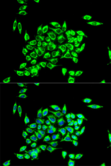 a02426 trap1 primary antiboties ihc testing 3